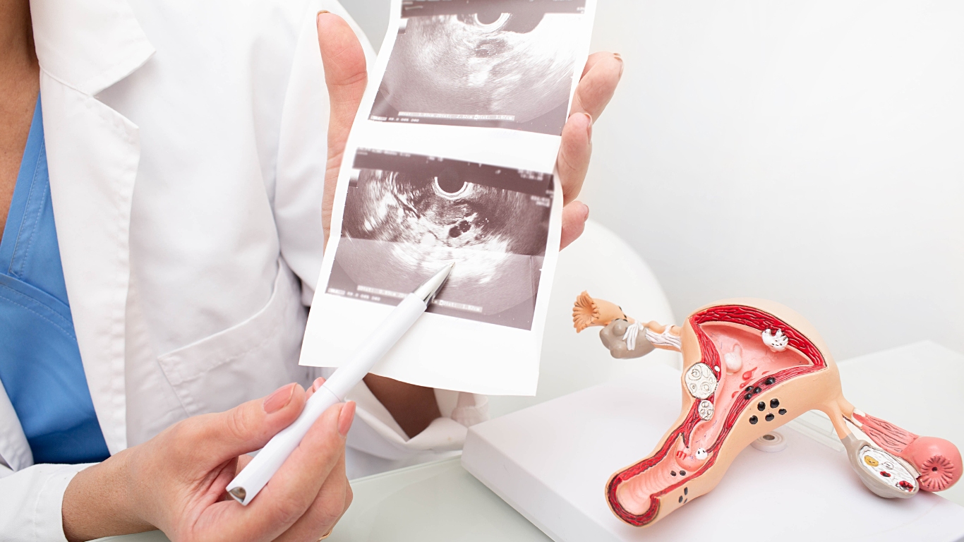 Use of autologous ADSCs for ovarian rejuvenation